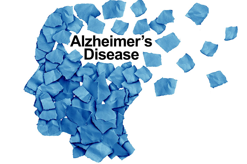 Memory Matters: Essential Knowledge About Early-Onset Alzheimer’s ...